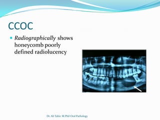 CCOC
 Radiographically shows
 honeycomb poorly
 defined radiolucency




              Dr. Ali Tahir. M.Phil Oral Pathology
 