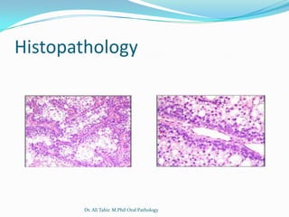 Histopathology




       Dr. Ali Tahir. M.Phil Oral Pathology
 