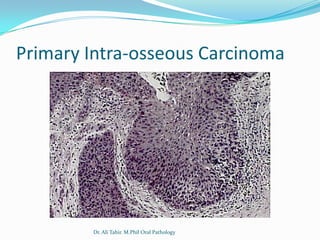Primary Intra-osseous Carcinoma




        Dr. Ali Tahir. M.Phil Oral Pathology
 