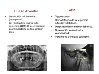 Hueso Alveolar
• Disminución volumen óseo
(osteoporosis).
• Los niveles de la enzima ciclo-
oxygenasa 2(COX-2), desempeña un
papel importante en la reparación
ósea.
ATM
• Osteoartrosis
• Remodelación de la superficie
articular y del disco.
• Desplazamiento anterior del disco.
• Disminución celularidad y
vascularidad.
• Incremento densidad colágeno.
 