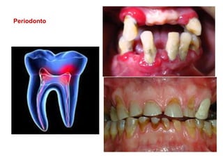 Periodonto
 
