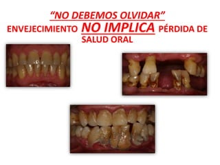 “NO DEBEMOS OLVIDAR”
ENVEJECIMIENTO NO IMPLICA PÉRDIDA DE
SALUD ORAL
 