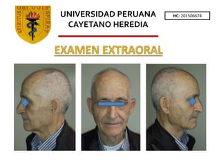 HC: 201506674
UNIVERSIDAD PERUANA
CAYETANO HEREDIA
 