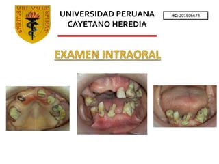 HC: 201506674
UNIVERSIDAD PERUANA
CAYETANO HEREDIA
 