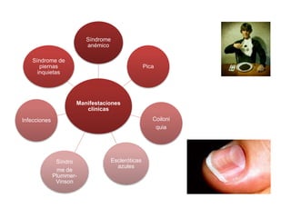 Manifestaciones
clínicas
Síndrome
anémico
Pica
Coiloni
quia
Escleróticas
azules
Síndro
me de
Plummer-
Vinson
Infecciones
Síndrome de
piernas
inquietas
 