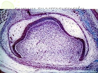 CAMPANA EN DIFERENCIACIÓN
CAMPANA EN DIFERENCIACIÓN
 