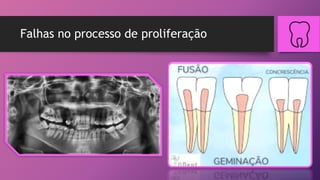 Falhas no processo de proliferação
 