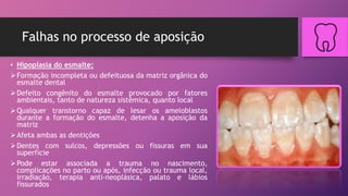 Falhas no processo de aposição
• Hipoplasia do esmalte:
Formação incompleta ou defeituosa da matriz orgânica do
esmalte dental
Defeito congênito do esmalte provocado por fatores
ambientais, tanto de natureza sistêmica, quanto local
Qualquer transtorno capaz de lesar os ameloblastos
durante a formação do esmalte, detenha a aposição da
matriz
Afeta ambas as dentições
Dentes com sulcos, depressões ou fissuras em sua
superfície
Pode estar associada a trauma no nascimento,
complicações no parto ou após, infecção ou trauma local,
irradiação, terapia anti-neoplásica, palato e lábios
fissurados
 