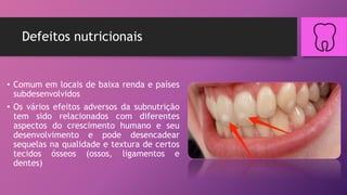 Defeitos nutricionais
• Comum em locais de baixa renda e países
subdesenvolvidos
• Os vários efeitos adversos da subnutrição
tem sido relacionados com diferentes
aspectos do crescimento humano e seu
desenvolvimento e pode desencadear
sequelas na qualidade e textura de certos
tecidos ósseos (ossos, ligamentos e
dentes)
 