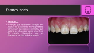 Fatores locais
• Radiação X:
 Crianças que receberam radiação em
excesso no tratamento de malignidades
apresentam hipoplasia de esmalte, que
poderá ser observada como uma linha
de esmalte hipoplásico, que se
desenvolve na época do tratamento
 