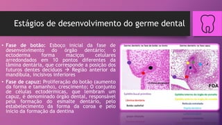 Estágios de desenvolvimento do germe dental
• Fase de botão: Esboço inicial da fase de
desenvolvimento do órgão dentário; o
ectoderma forma maciços celulares
arredondados em 10 pontos diferentes da
lâmina dentária, que corresponde a posição dos
futuros dentes decíduos  Região anterior da
mandíbula, incisivos inferiores
• Fase de capuz: Proliferação do botão (aumento
da forma e tamanho), crescimento; O conjunto
de células ectodérmicas, que lembram um
capuz, é denominado órgão dental, responsável
pela formação do esmalte dentário, pelo
estabelecimento da forma da coroa e pelo
início da formação da dentina
 