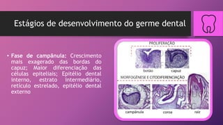Estágios de desenvolvimento do germe dental
• Fase de campânula: Crescimento
mais exagerado das bordas do
capuz; Maior diferenciação das
células epiteliais; Epitélio dental
interno, estrato intermediário,
retículo estrelado, epitélio dental
externo
 