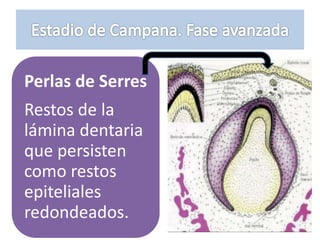 Perlas de Serres
Restos de la
lámina dentaria
que persisten
como restos
epiteliales
redondeados.
 