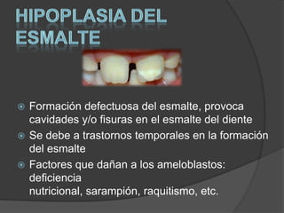  Formación defectuosa del esmalte, provoca
  cavidades y/o fisuras en el esmalte del diente
 Se debe a trastornos temporales en la formación
  del esmalte
 Factores que dañan a los ameloblastos:
  deficiencia
  nutricional, sarampión, raquitismo, etc.
 