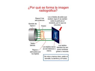 ¿Por qué se forma la imagen radiográfica? 