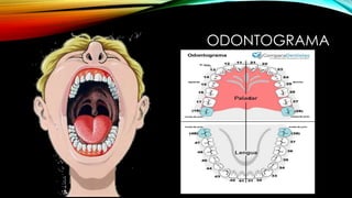 ODONTOGRAMA
 