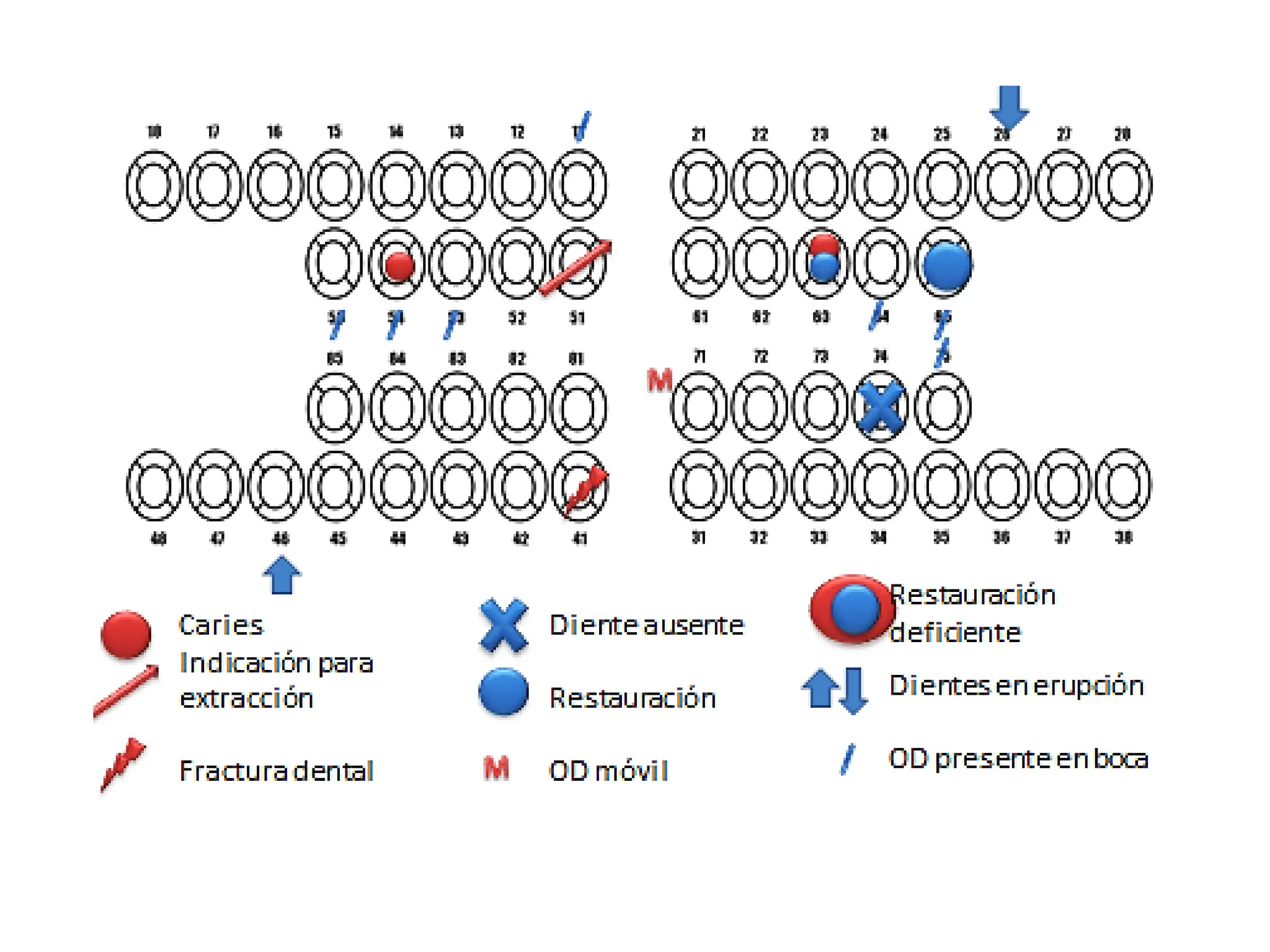 ODONTOGRAMA Ayuda Para Llenado De Odontograma PDF odontograma-ayuda-para-llenado-de-odontograma-pdf