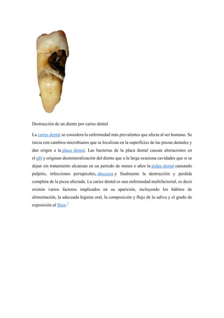 Destrucción de un diente por caries dental
La caries dental se considera la enfermedad más prevalentes que afecta al ser humano. Se
inicia con cambios microbianos que se localizan en la superficies de las piezas dentales y
dan origen a la placa dental. Las bacterias de la placa dental causan alteraciones en
el pH y originan desmineralización del diente que a la larga ocasiona cavidades que si se
dejan sin tratamiento alcanzan en un periodo de meses o años la pulpa dental causando
pulpitis, infecciones periapicales, abscesos y finalmente la destrucción y perdida
completa de la pieza afectada. La caries dental es una enfermedad multifactorial, es decir
existen varios factores implicados en su aparición, incluyendo los hábitos de
alimentación, la adecuada higiene oral, la composición y flujo de la saliva y el grado de
exposición al fluor.7
 