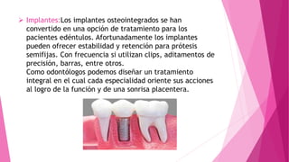  Implantes:Los implantes osteointegrados se han
convertido en una opción de tratamiento para los
pacientes edéntulos. Afortunadamente los implantes
pueden ofrecer estabilidad y retención para prótesis
semifijas. Con frecuencia si utilizan clips, aditamentos de
precisión, barras, entre otros.
Como odontólogos podemos diseñar un tratamiento
integral en el cual cada especialidad oriente sus acciones
al logro de la función y de una sonrisa placentera.
 