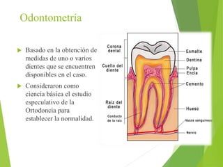Odontometría 
 Basado en la obtención de 
medidas de uno o varios 
dientes que se encuentren 
disponibles en el caso. 
 Consideraron como 
ciencia básica el estudio 
especulativo de la 
Ortodoncia para 
establecer la normalidad. 
 