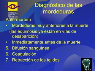 Diagnóstico de las mordeduras Ante-mortem Mordeduras muy anteriores a la muerte (las equimosis ya están en vías de desaparición) Inmediatamente antes de la muerte Difusión sanguínea Coagulación Retracción de los tejidos G.B.P 