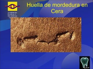 Huella de mordedura en Cera G.B.P 