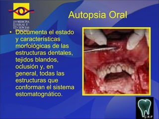 Autopsia Oral Documenta el estado y características morfológicas de las estructuras dentales, tejidos blandos, oclusión y, en general, todas las estructuras que conforman el sistema estomatognático. G.B.P 