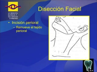 Disección Facial Incisión perioral Remueve el tejido perioral G.B.P 