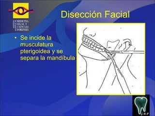 Disección Facial Se incide la musculatura pterigoidea y se separa la mandíbula G.B.P 