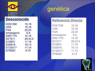 genética Desconocido D3S1358  15,18 vWA 15,16 FGA 22,23 Amelogenin   X,X D8S1179 14,16 D21S11 28,33.2 D18S51 11,16 D5S818 10,13 D13S317 11,14 D7S820   9,10 Referencia Directa D3S1358  15,18 vWA 15,16 FGA 22,23 Amelogenin   X,X D8S1179 14,16 D21S11 28,33.2 D18S51 11,16 D5S818 10,13 D13S317 11,14 D7S820   9,10 G.B.P 