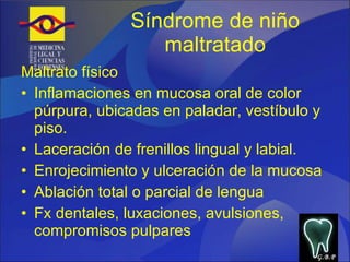 Síndrome de niño maltratado Maltrato físico Inflamaciones en mucosa oral de color púrpura, ubicadas en paladar, vestíbulo y piso. Laceración de frenillos lingual y labial. Enrojecimiento y ulceración de la mucosa Ablación total o parcial de lengua Fx dentales, luxaciones, avulsiones, compromisos pulpares G.B.P 