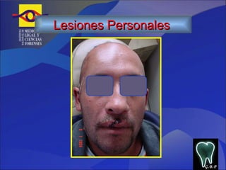 G.B.P Lesiones Personales   