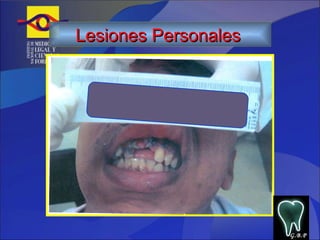 G.B.P Lesiones Personales   