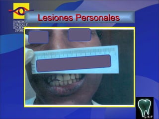 G.B.P Lesiones Personales   