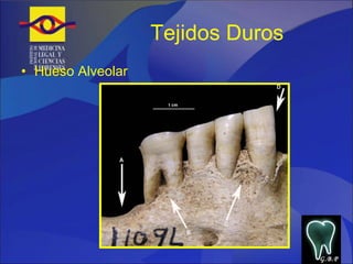 Tejidos Duros Hueso Alveolar G.B.P 