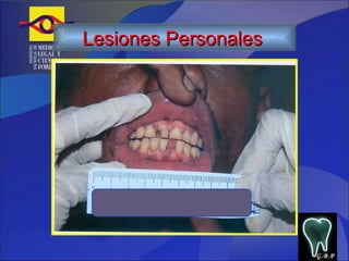 G.B.P Lesiones Personales   