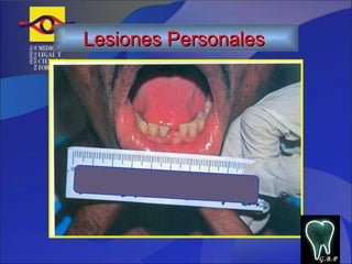 G.B.P Lesiones Personales   