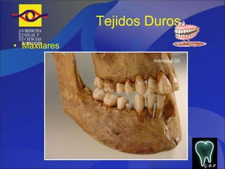 Tejidos Duros Maxilares  G.B.P 