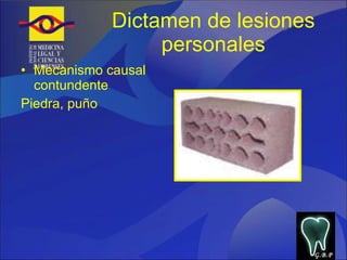 Dictamen de lesiones personales Mecanismo causal contundente  Piedra, puño G.B.P 