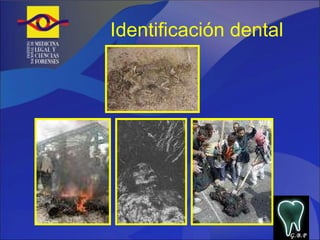 Identificación dental G.B.P 