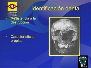 Identificación dental Resistencia a la destrucción Características propias G.B.P 