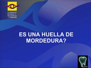 ES UNA HUELLA DE MORDEDURA? G.B.P 
