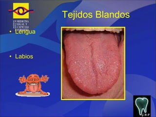 Tejidos Blandos Lengua Labios  G.B.P 