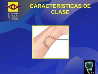 CARACTERISTICAS DE CLASE G.B.P 