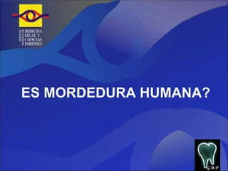 ES MORDEDURA HUMANA? G.B.P 