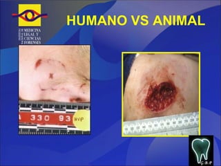 HUMANO VS ANIMAL G.B.P 