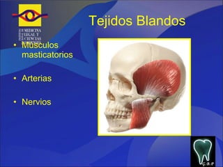 Tejidos Blandos Músculos masticatorios Arterias Nervios  G.B.P 
