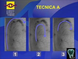 TECNICA A 1 2 3 G.B.P 