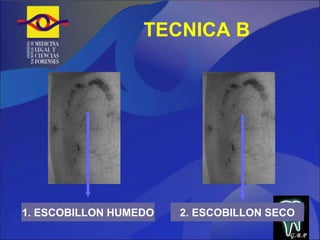 TECNICA B 1. ESCOBILLON HUMEDO 2. ESCOBILLON SECO G.B.P 