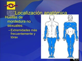Localización anatómica Huellas de mordedura no sexuales: Extremidades más frecuentemente y tórax G.B.P 
